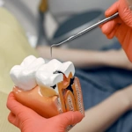 campaign-Root Canal Treatment 150