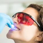 campaign-Teeth Whitening 150