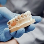 campaign-dental bridges 150