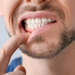 campaign-periodontics 150