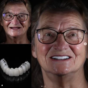 denta marla smile 01
