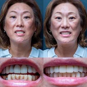 denta marla smile 04