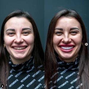 denta marla smile 09