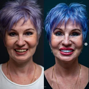 denta marla smile 10