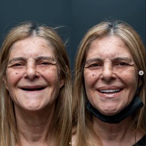 denta marla smile 11