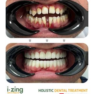 dr tevfik yavuz bna 02