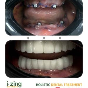 dr tevfik yavuz bna 06